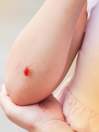 8-steps-for-basic-wound-care-in-emergency-situations-article-324x432