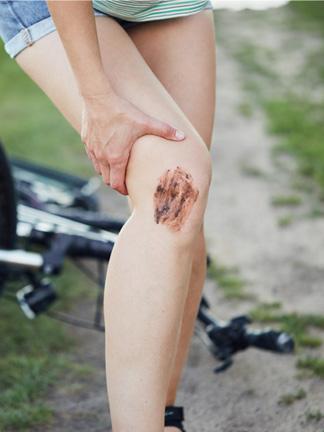 wound care treatment for different lifestyle - detail