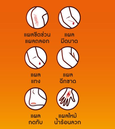 Betadine_Introduction to Wound Types_Blog_464x512