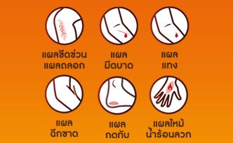 การแบ่งประเภทของบาดแผลและการรักษาเบื้องต้น