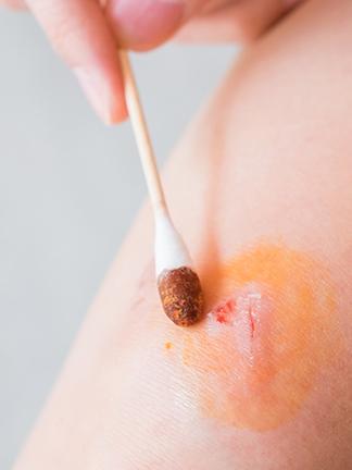 wound-care-101-revealing-tips-for-effective-wound-care-article-324x432